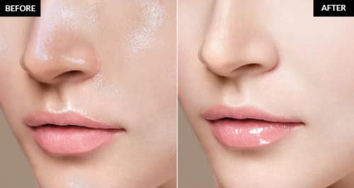  how to get rid of oily skin permanently