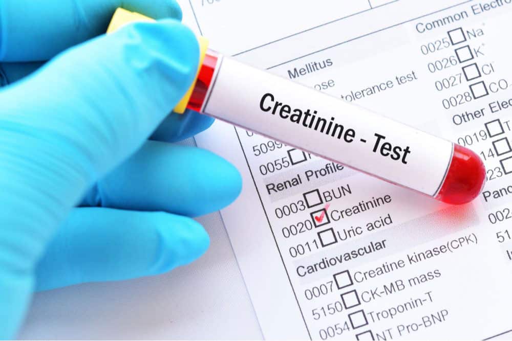 When to worry about Creatinine Levels