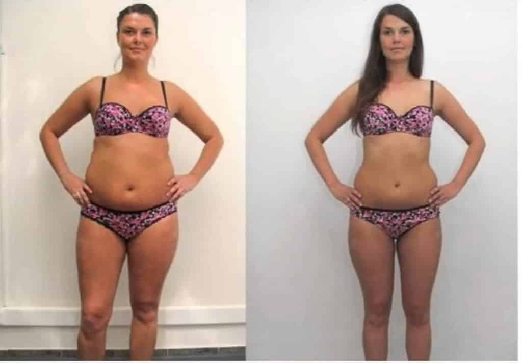 truvision weight loss